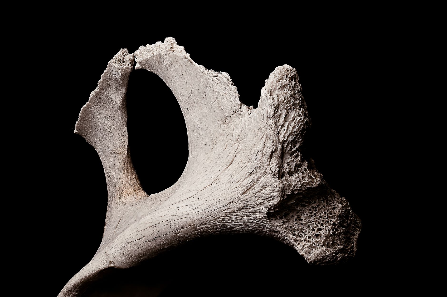 Bone Density and the Calcium Conversation: What Women Need to Know